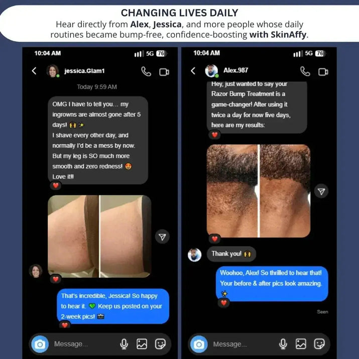 SkinAffy™ Fast - Acting Ingrown Hair Treatment - My Store