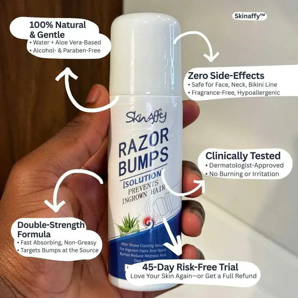 SkinAffy™ Fast-Acting Ingrown Hair Treatment My Store