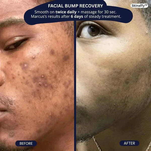 SkinAffy™ Dark Spot Clearing Serum