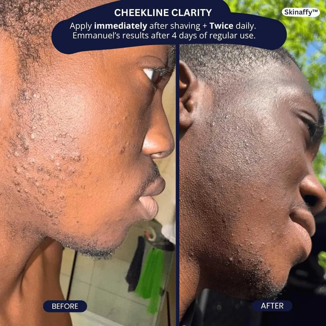 SkinAffy™ Dark Spot Clearing Serum