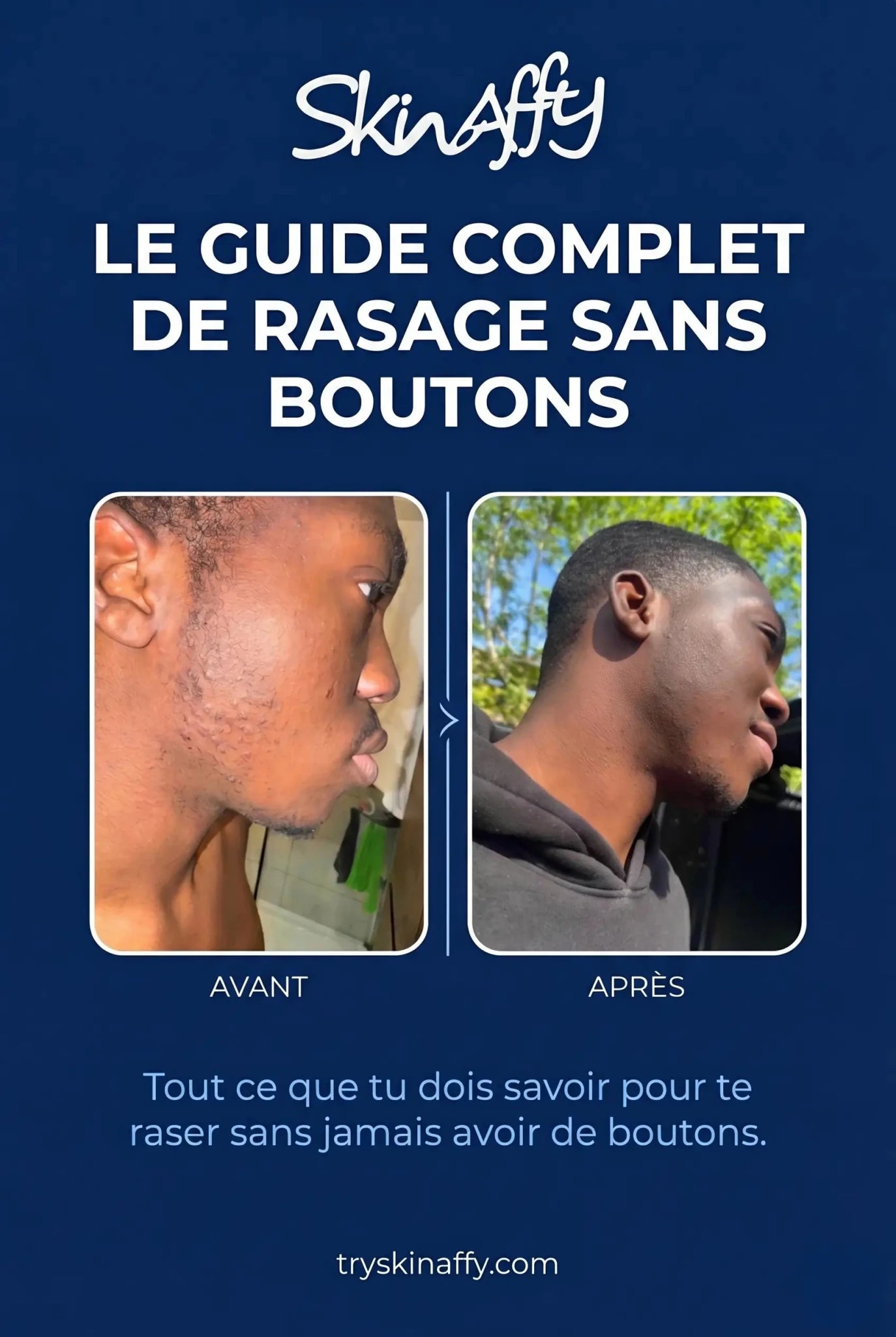 Le Guide Complet de Rasage Sans Boutons